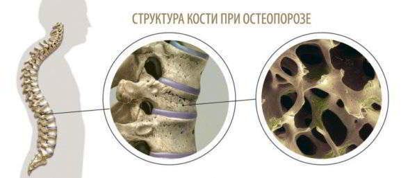 Структура кости