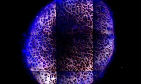 Лечение артроза наночастицами - микрофотография