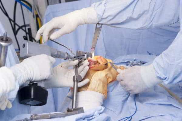операция на голеностоп