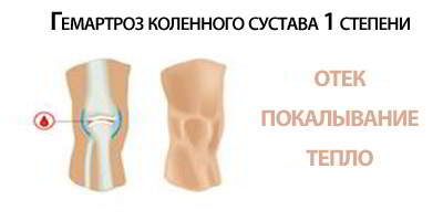 Изображение - Гемартроз коленного сустава после 1-2-stepen-gemartroza-kolennogo-sustava