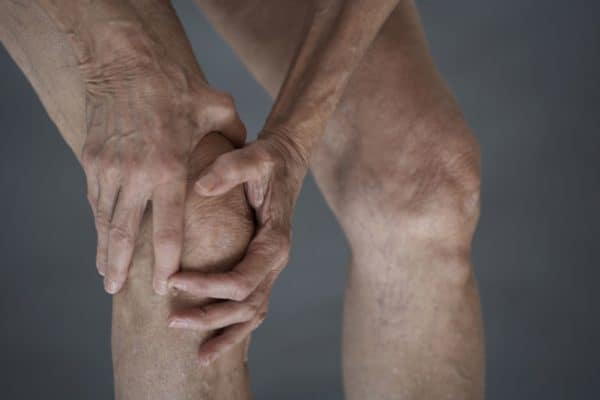 Анкилоз коленного сустава
