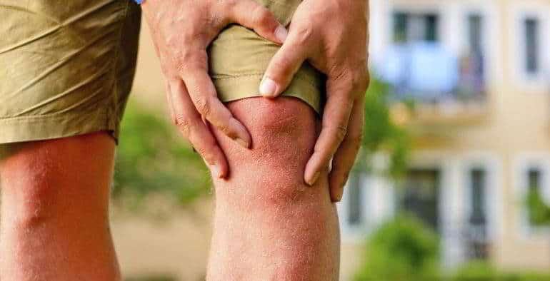 Коксартроз коленного сустава симптомы и лечение