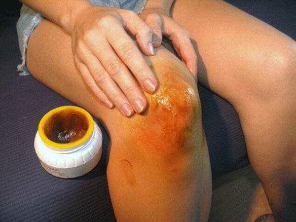 Изображение - Лечение суставов рук в домашних условиях domashnyaya-maz-600x450