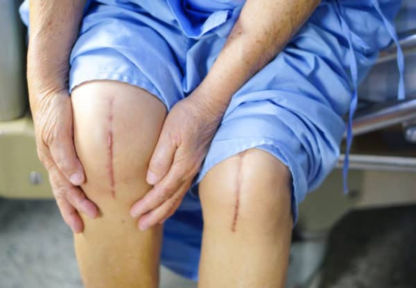 Три причины отложить эндопротезирование коленного сустава