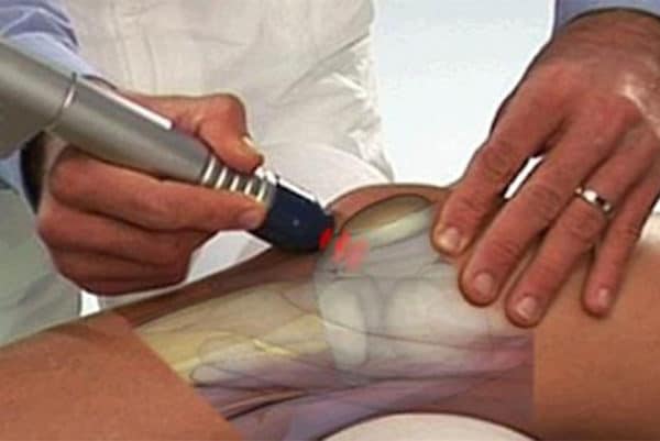 Изображение - Как лечится гонартроз коленного сустава ultrazvuk-pri-gonartroze-600x401